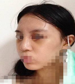 艺美门智和综合隆鼻，你值得拥有