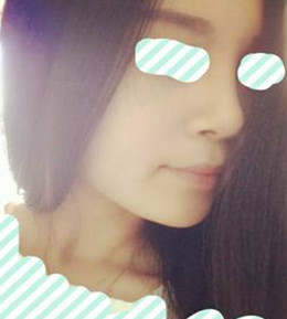 艺美门智和综合隆鼻，你值得拥有