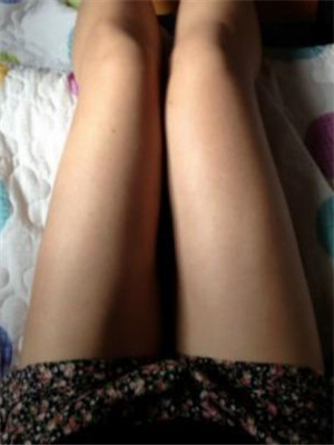 大腿吸脂后的长腿美女就是我