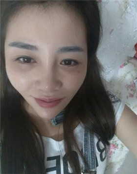 来评价一下华美刘琦做的高强度聚焦超声吧