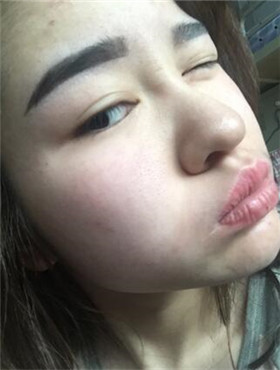 杜姜给我打了水光补水看起来皮肤嫩嫩的