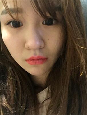 杜姜给我打了水光补水看起来皮肤嫩嫩的