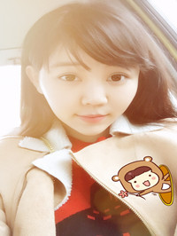 开外眼角手术前后过程对比图片