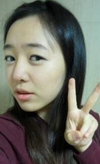 耳软骨隆鼻前后过程图片，见证我变美的过程