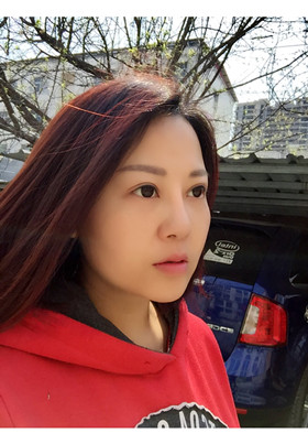 自体脂肪填充面部前后对比图片，真的美了美了!