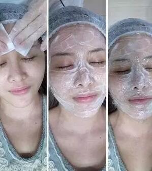 成都玉之光激光嫩肤经历 爱美的MM一定要看