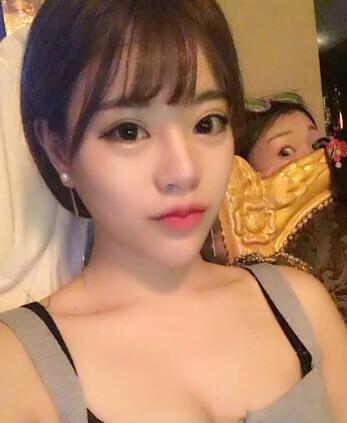北京禾美嘉注射玻尿酸丰唇+丰卧蚕 让我更美啦~