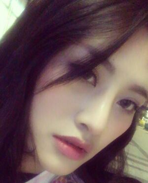 赵煜楠给做的隆鼻整形，看看我鼻子果怎么样