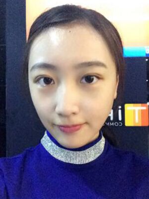 何贤清全切双眼皮加去脂肪 果贼自然