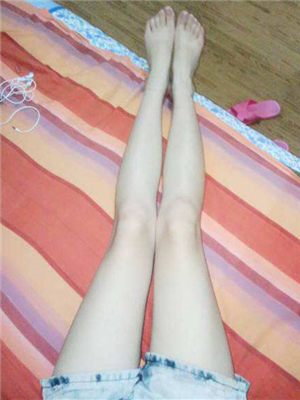 去年东方和谐张准医生做的大腿抽脂，分享一下我的前后对比果图片！