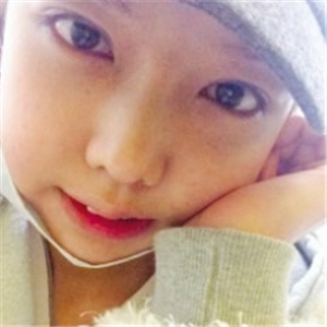 米扬丽格夏正义做双眼皮果怎么样？看看我的前后对比果图片吧！