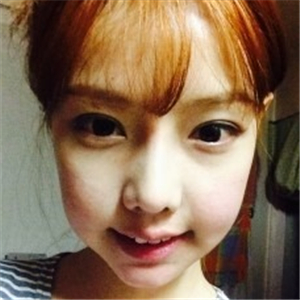 米扬丽格夏正义做双眼皮果怎么样？看看我的前后对比果图片吧！