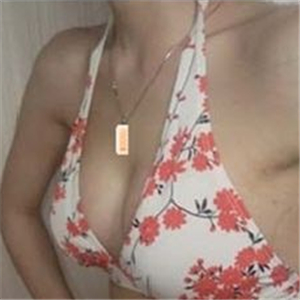 南昌同济做的极速动感微创丰胸术，分享下我的恢复过程图片吧~