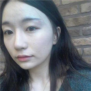 赵雅雄做下颌角整形成好吗？看看我的前后对比图片就知道了~