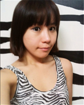 下颌角整形做完变小脸 孙丽君医生棒棒哒