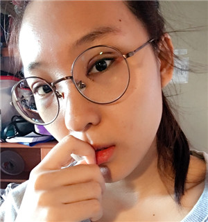 秦宏伟做的双眼皮多项整形 丑小鸭的蜕变啊