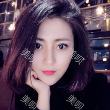 自体脂肪隆鼻+割双眼皮恢复后的果我很满意