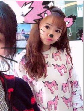 金颂良医生给我打的B****，终于摆脱婴儿肥啦！！！