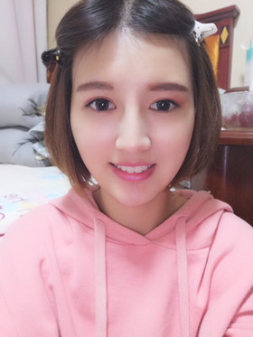 注射瘦脸去抬头纹，找回属于我的年龄，感谢金颂良医生！