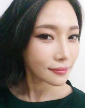 柳大烈给我做的改脸型手术 求围观！