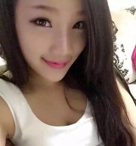 徐和林医生给我注射玻尿酸隆鼻后颜值up