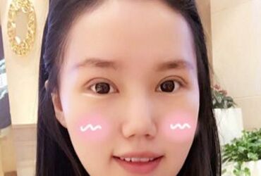 双眼皮让我眼睛变得更大更漂亮啦