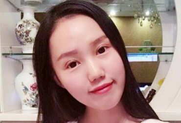 双眼皮让我眼睛变得更大更漂亮啦