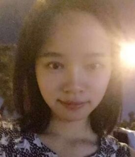 全切双眼皮+去脂肪，终于摆脱小眼睛了