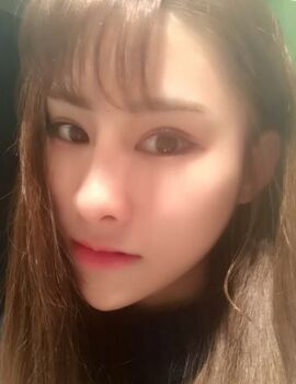 硅胶隆鼻还垫鼻尖了，甘泉涌做的果真的很好哟