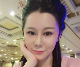 隆鼻失败修复后再次获得完精致的美鼻