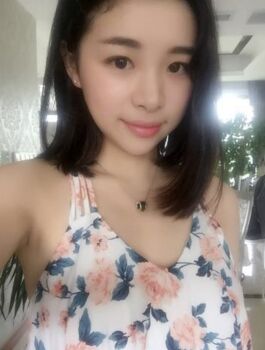 合肥杨鹏隆鼻整形真实案例分享