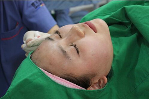 我做高强度聚焦超声面b提升真实经历 继续做我的少女