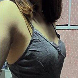 自体脂肪隆胸真的变大胸了 感谢成都天使之翼