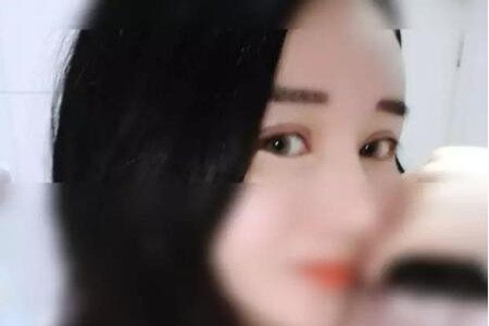 成都天使之翼做的双眼皮修复怎么样 快来围观