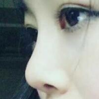 将自己隆鼻恢复过程分享给大家，希望对有需求的MM有帮助