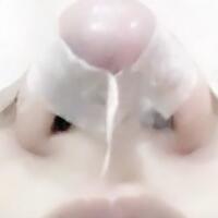 假体隆鼻，耳软骨垫鼻尖，鼻头缩小等隆鼻整形分享