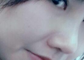 鼻子整形图片分享