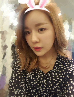 v－line手术后变小脸美眉 伊美尔孙丽君做的