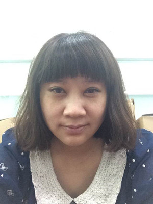 秦宏伟给我做了埋埋蛋白线.提升 变年轻了