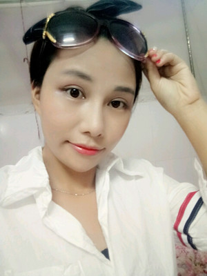 美莱邓正辉做的切开双眼皮 终于变美了