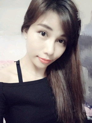 美莱邓正辉做的切开双眼皮 终于变美了