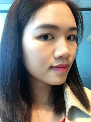 多亏了付俊俐医生做的隆鼻整形 脸变立体了