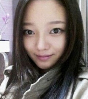 假体隆鼻手术过程前后对比图片