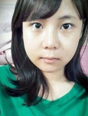 柳大烈给我做的磨下颌角 看看我的果如何~