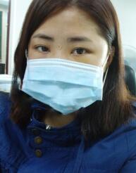 在北京炫美磨了下颌角 恢复纪实分享