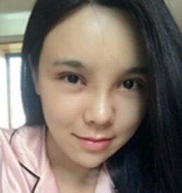 职业模特为变美下定决心做了隆鼻整形
