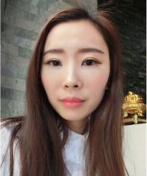 自体脂肪面部填充告别干瘪消瘦的脸