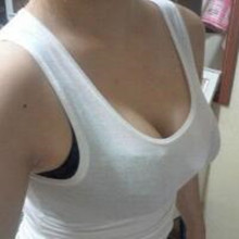 假体隆胸让我告别小平胸 感谢北京彤美