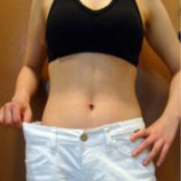 抽脂减肥瘦小腹 终于可以不用节食锻炼了