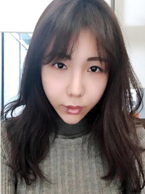 玻尿酸去除法令纹后人生明朗了 军美王世虎做的